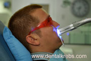 Blanqueamiento Dental 