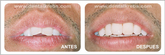 Est�tica y Cosm�tica dental