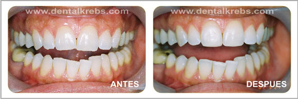 Est�tica y Cosm�tica dental