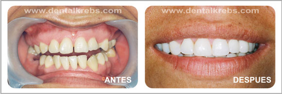 Est�tica y Cosm�tica dental