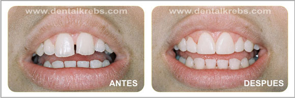 Est�tica y Cosm�tica dental