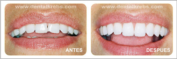 Est�tica y Cosm�tica dental