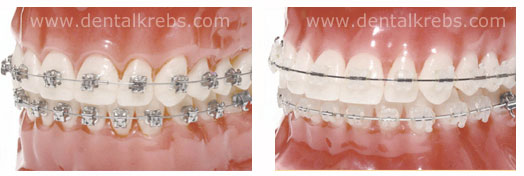 Dentista Ortodoncia
