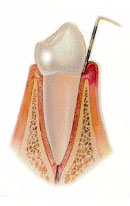 Periodoncia