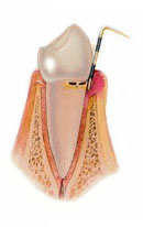 Periodoncia