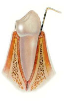 Periodoncia