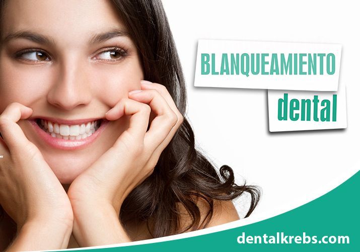 Blanqueamiento Dental en Lima