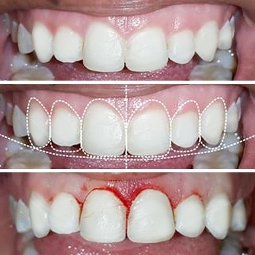 Causas de Endodoncia