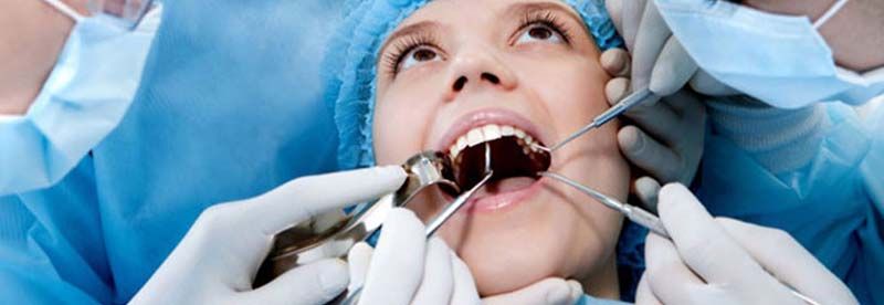 Cirugia Oral