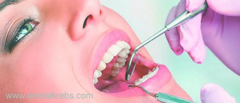 Dentista en San Isidro lima