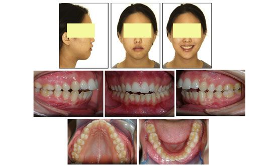 Imagen Intraoral