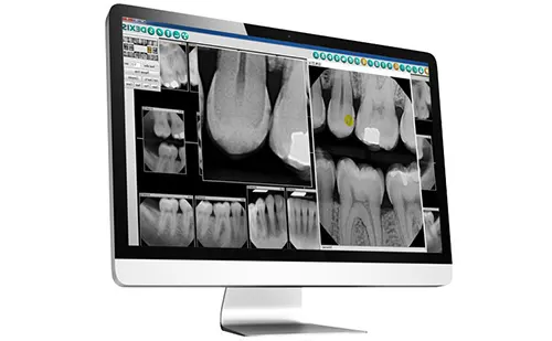 Radiografia Periapical